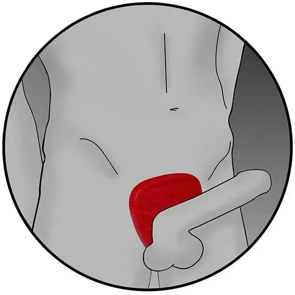 3-inch Electrastim Red Silicone Fusion Viper Bipolar Cock Ring